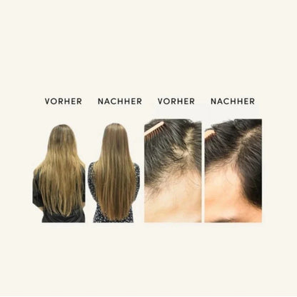 SKINBDY Natürliches Haarwachstumsöl